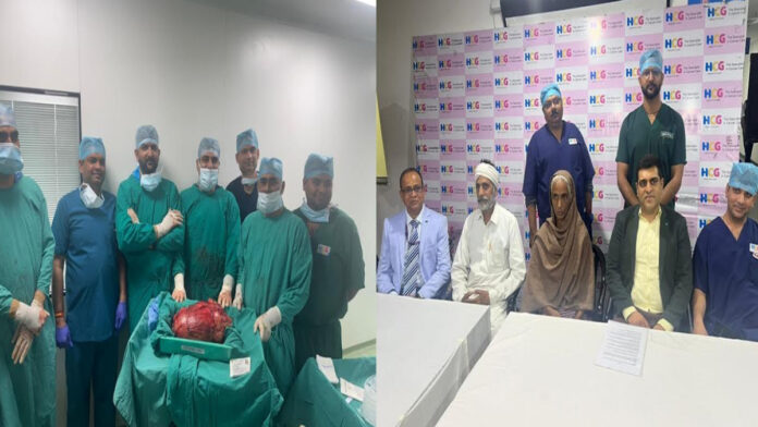 HCG Cancer Center in Jaipur successfully performed surgery to remove a massive 8.5 kg thigh tumor.