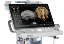 रितु आईवीएफ ने की राजस्थान में पहली बार कृत्रिम बुद्धिमत्ता युक्त अल्ट्रासाउंड मशीन की स्थापना Ritu IVF has installed the first artificial intelligence-powered ultrasound machine in Rajasthan.