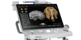 रितु आईवीएफ ने की राजस्थान में पहली बार कृत्रिम बुद्धिमत्ता युक्त अल्ट्रासाउंड मशीन की स्थापना Ritu IVF has installed the first artificial intelligence-powered ultrasound machine in Rajasthan.