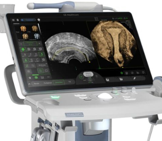 रितु आईवीएफ ने की राजस्थान में पहली बार कृत्रिम बुद्धिमत्ता युक्त अल्ट्रासाउंड मशीन की स्थापना Ritu IVF has installed the first artificial intelligence-powered ultrasound machine in Rajasthan.