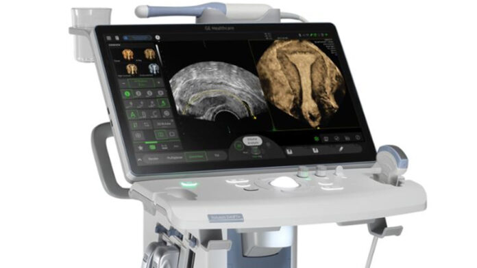 Ritu IVF has installed the first artificial intelligence-powered ultrasound machine in Rajasthan.