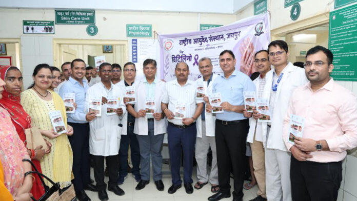 Free medical camp at NIA on World Vitiligo Day