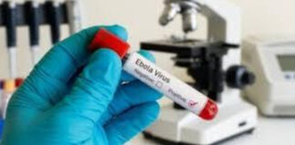 जयपुर घूमने आई युगांडा युवती में इबोला जैसे लक्षण मिलने से स्वास्थ्य महकमे में हलचल A Ugandan woman visiting Jaipur has been found to have Ebola-like symptoms, causing a stir in the health department.